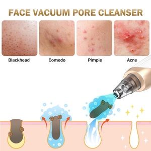 Skincare | Blackhead Remover Pore Vacuumupgraded Facial Electric ...